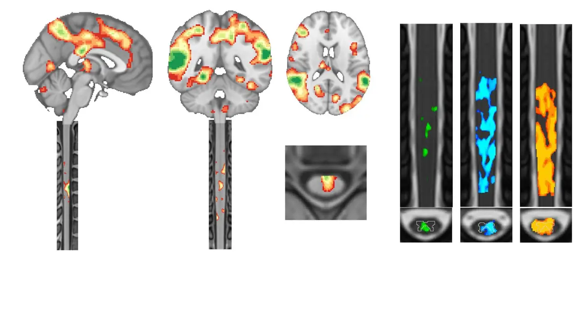 Functional MRI looks beyond the brain to reveal spinal cord activity