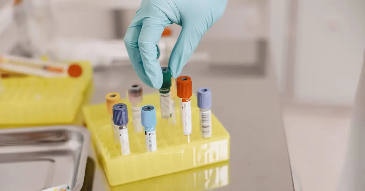 Current age-based genetic testing in patients with cancer may miss the majority of inherited gene variants