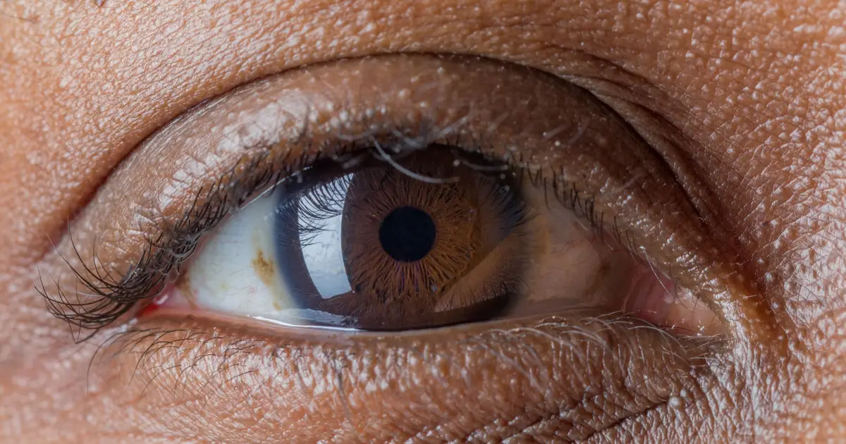 Genetic information helps predict the onset and progression of glaucoma