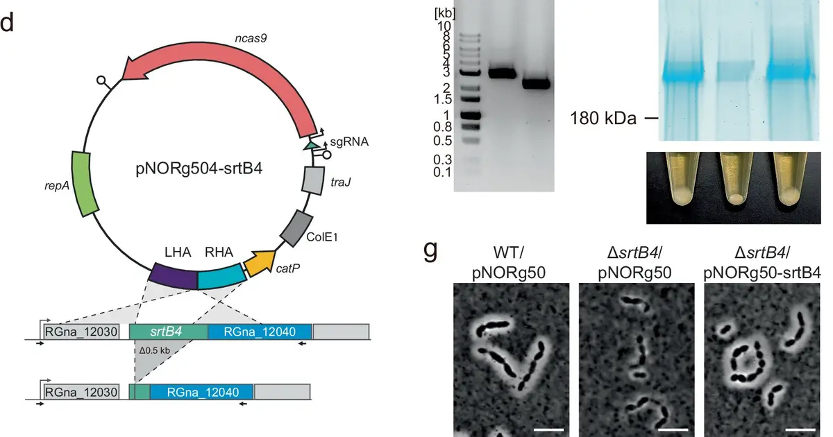 Gut microbe's protective coating links intestinal colonization to lower inflammation