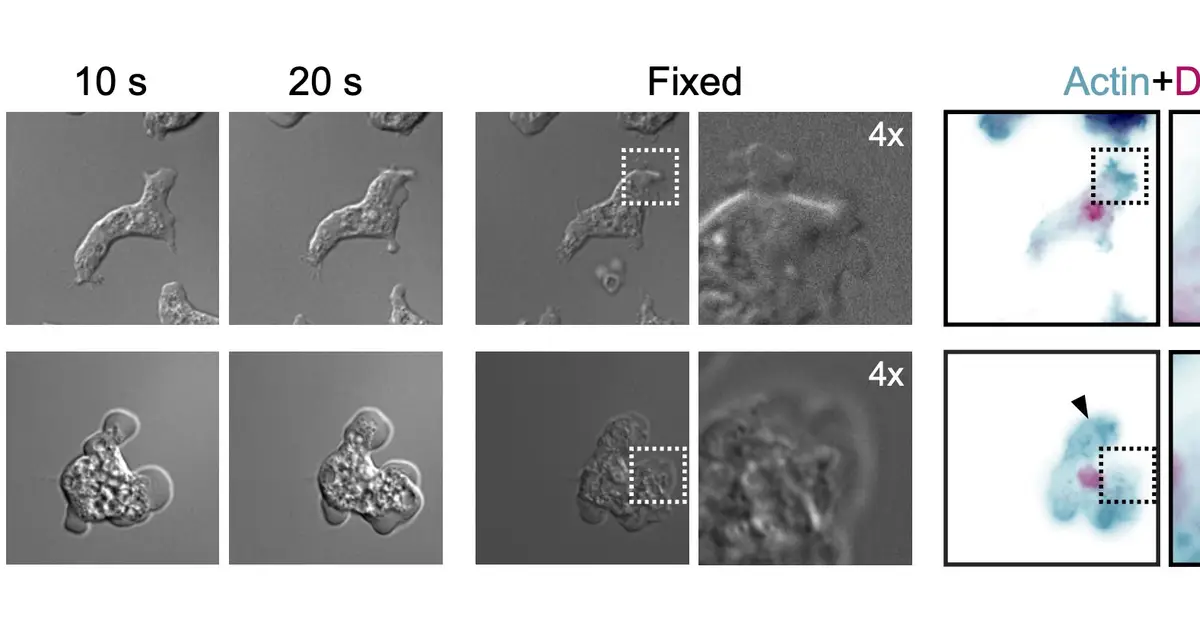 Harmless amoeba's tight-space crawling offers clues to how its deadly relative invades the brain