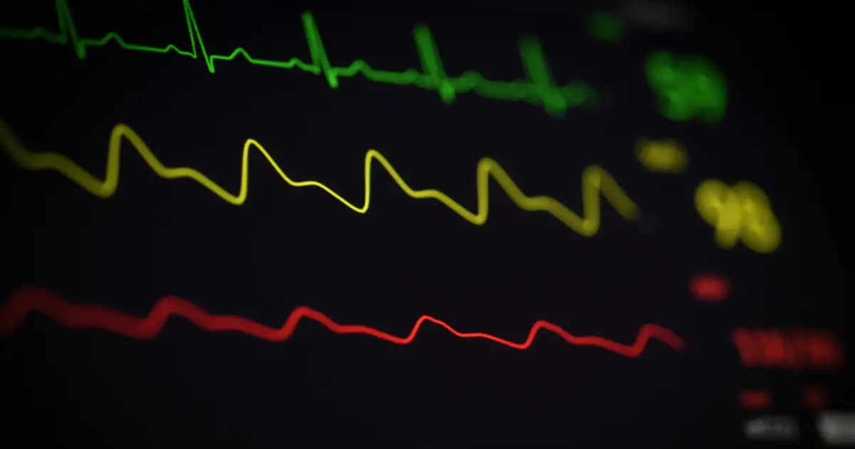 New global definition of myocardial infarction aims to improve diagnosis, treatment and patient understanding