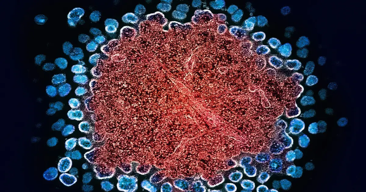Teaching the immune system to control HIV