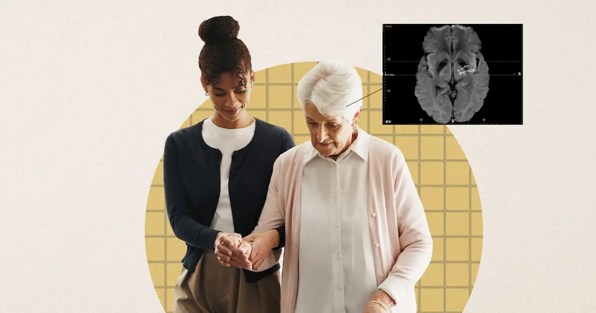 First dual-target high-intensity focused ultrasound procedure for people with advanced Parkinson's disease