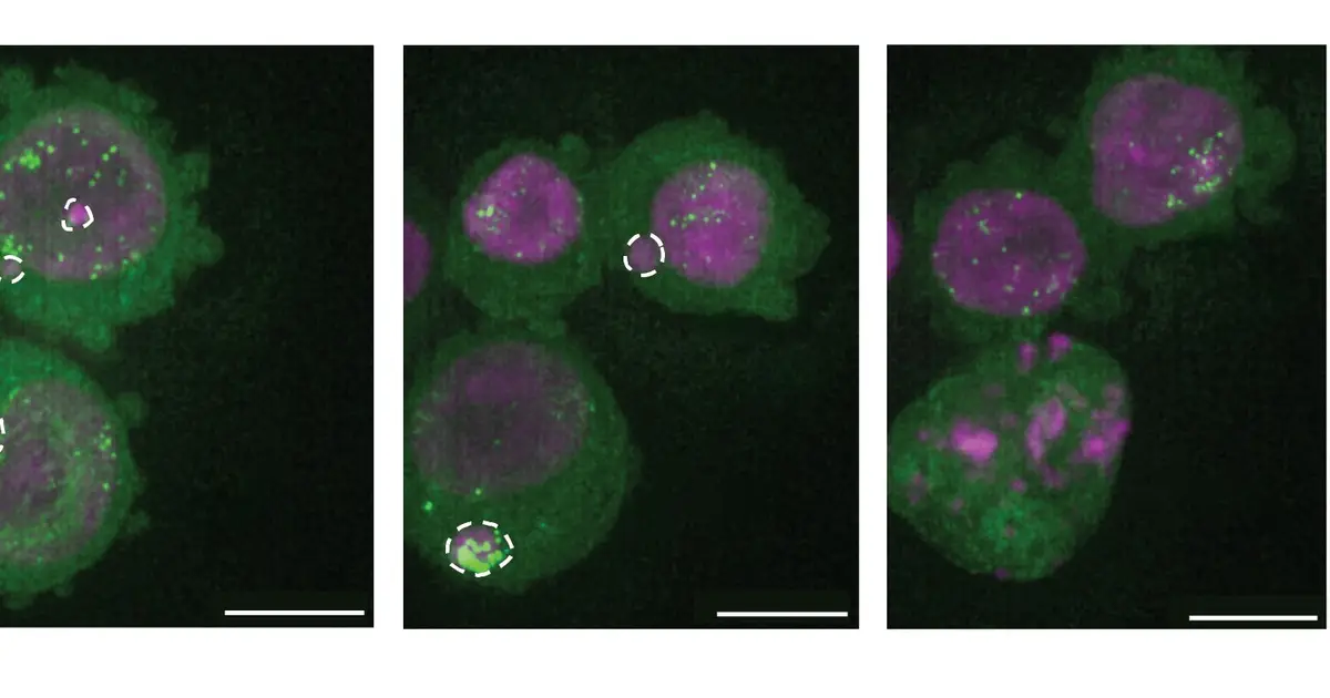 Trapping cancer-driving DNA rings outside cell nucleus silences their genes, researchers find