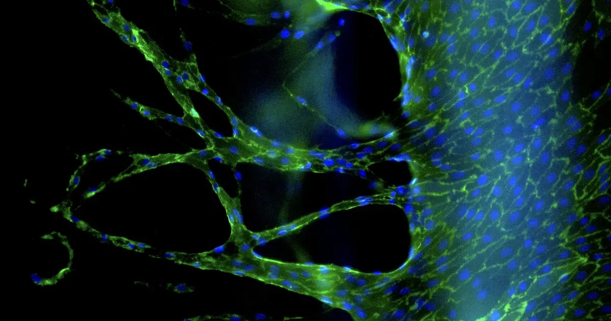 How our blood vessels age from within