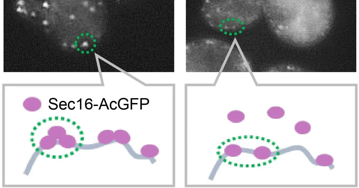 How stressed cells put the brakes on protein 'shipping'