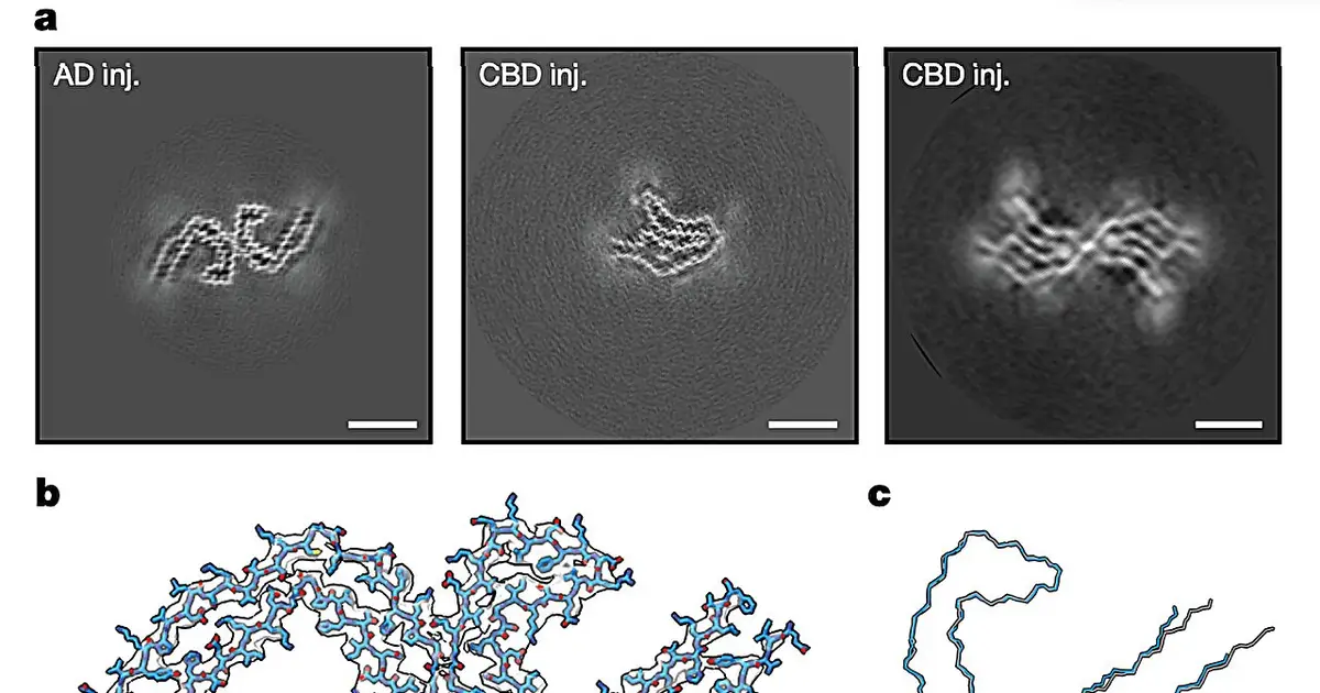 Human tau seeds trigger disease-specific shapes in mouse brains, new study finds