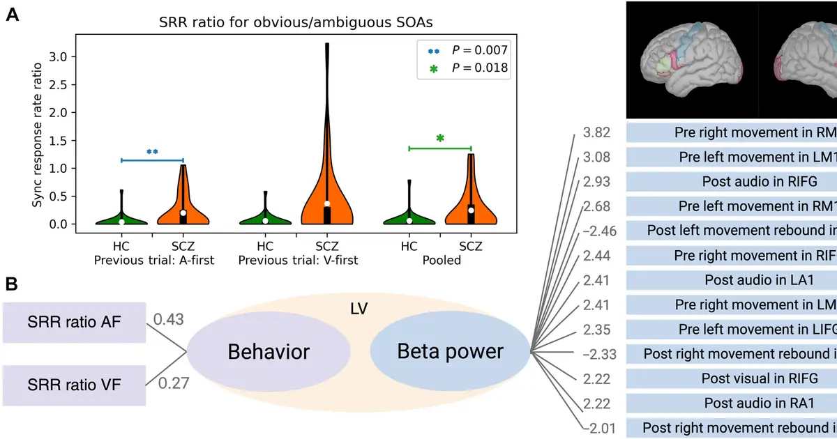 Imaging study links several schizophrenia symptoms to a single brain signal