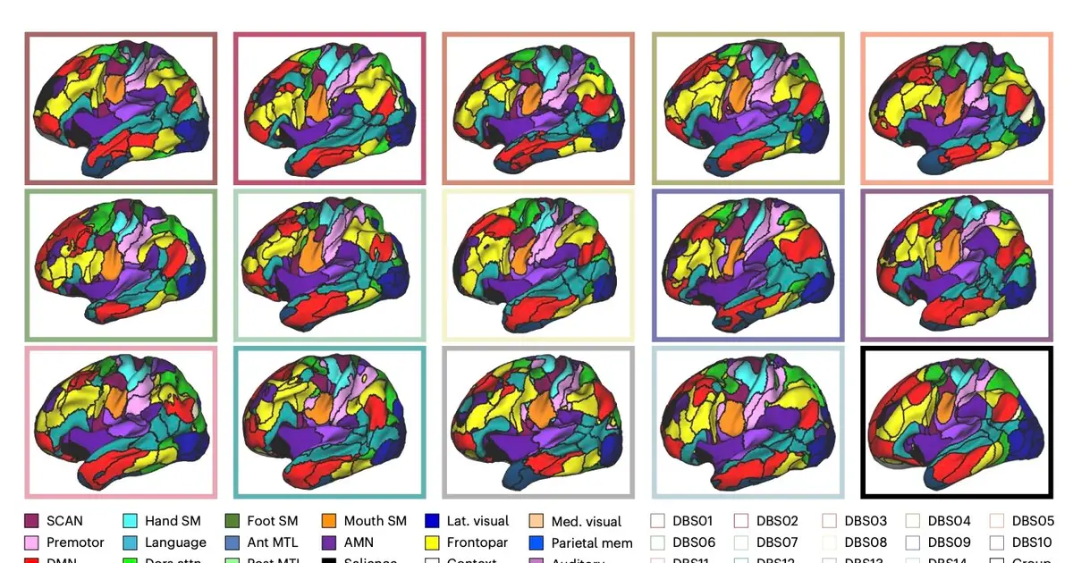 Imaging study sheds light on how deep brain stimulation acts on Parkinson's disease