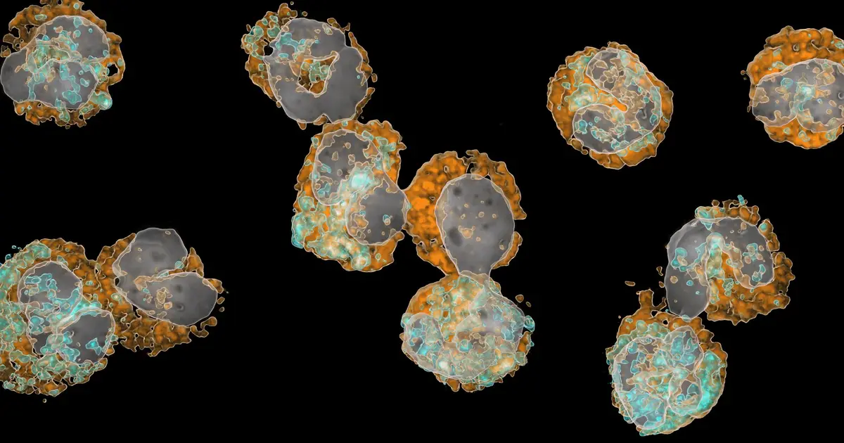 Immature immune cells predict chances of survival following a heart attack