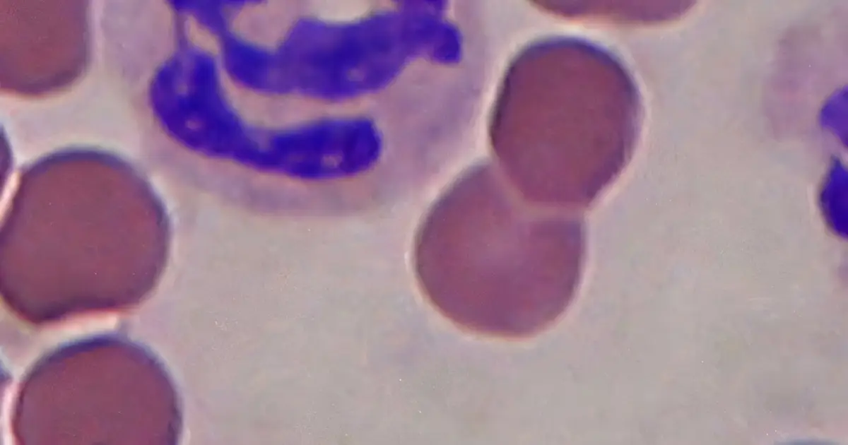 Immune navigation system discovery could lead to better treatments for chronic inflammation