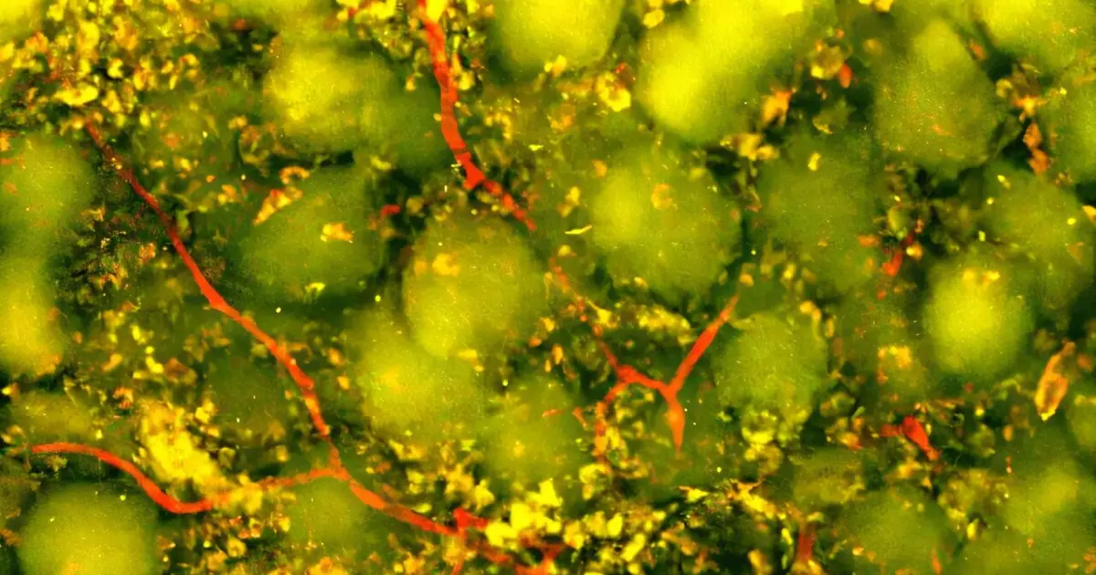 Injectable biomaterial harnesses the immune system to promote brain repair after stroke
