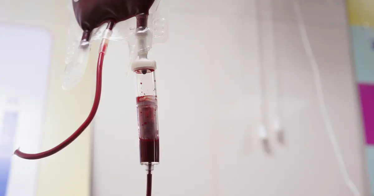 Iron transfusion before heart surgery reduces complications and boosts recovery, clinical trial finds