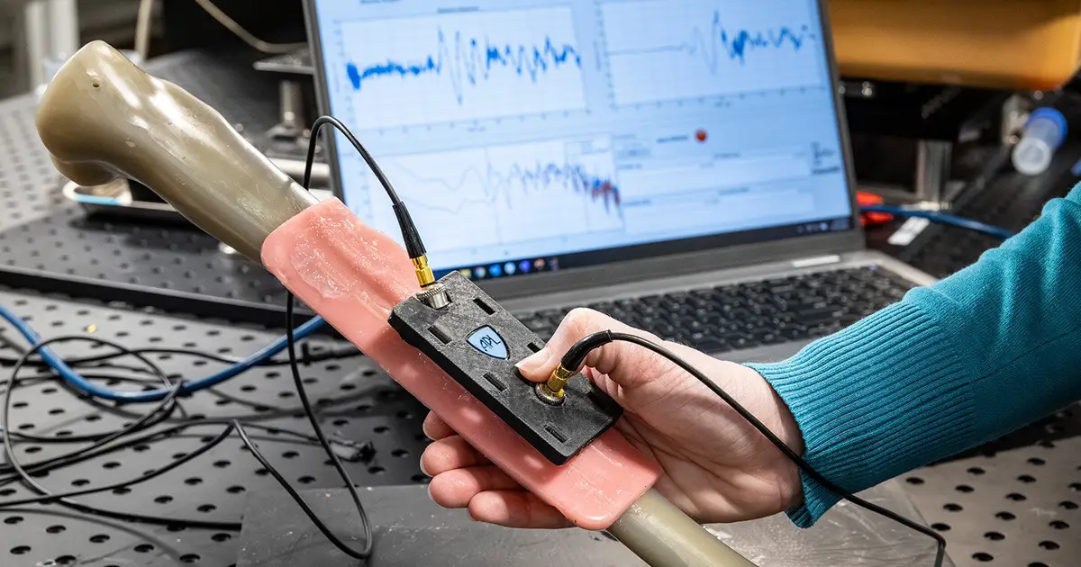 Ultrasonic technology enables earlier stress-fracture detection