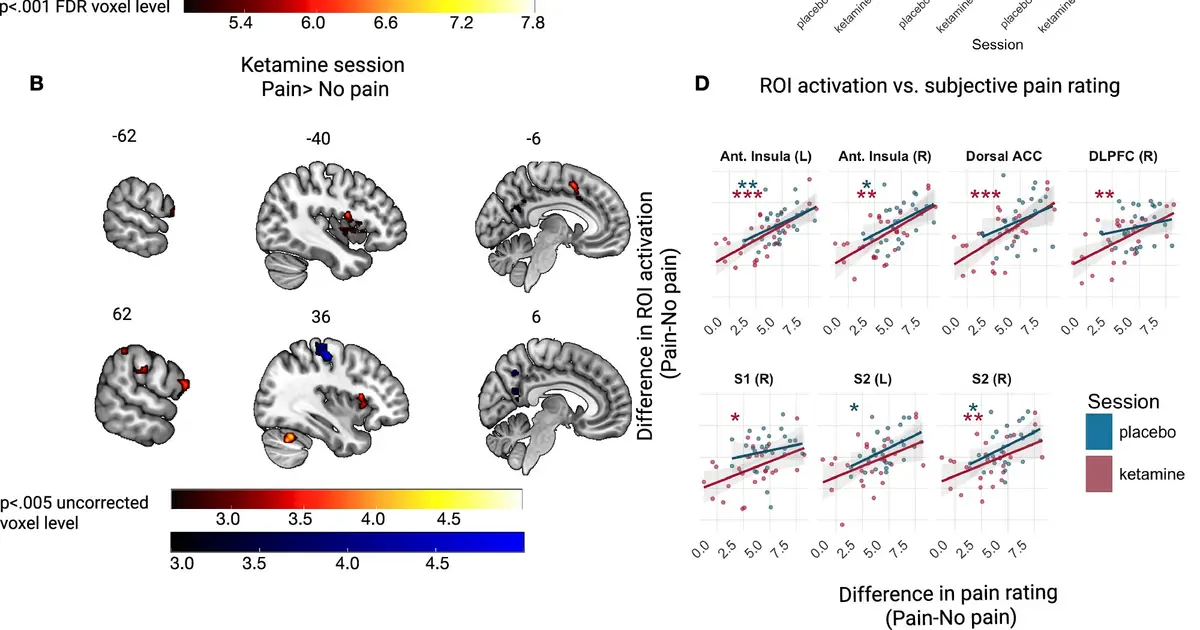 Ketamine relieves pain without 'disconnecting' consciousness, study finds