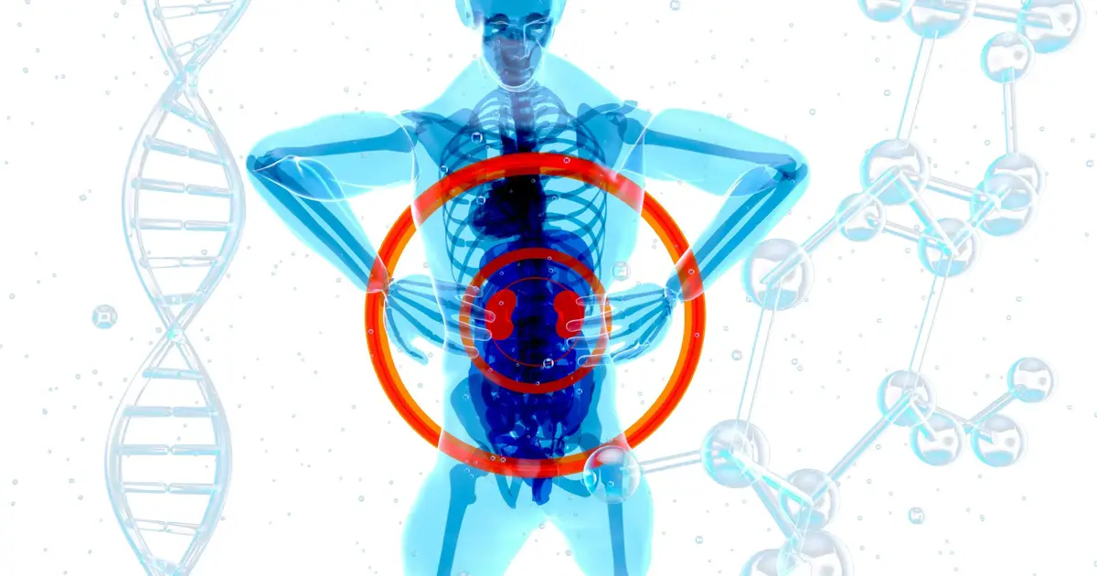 Experimental drug combination shows early effectiveness in advanced kidney cancer