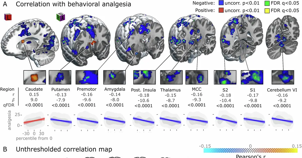 Large-scale brain analysis reveals multiple pathways to placebo effects on pain
