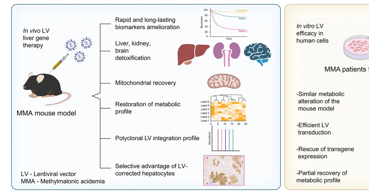 Liver-directed gene therapy shows preclinical efficacy for severe inherited metabolic disorder