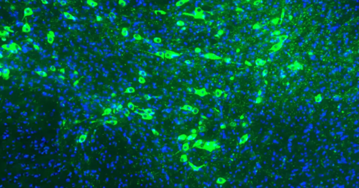 Managing misfolded proteins to prevent Parkinson's disease