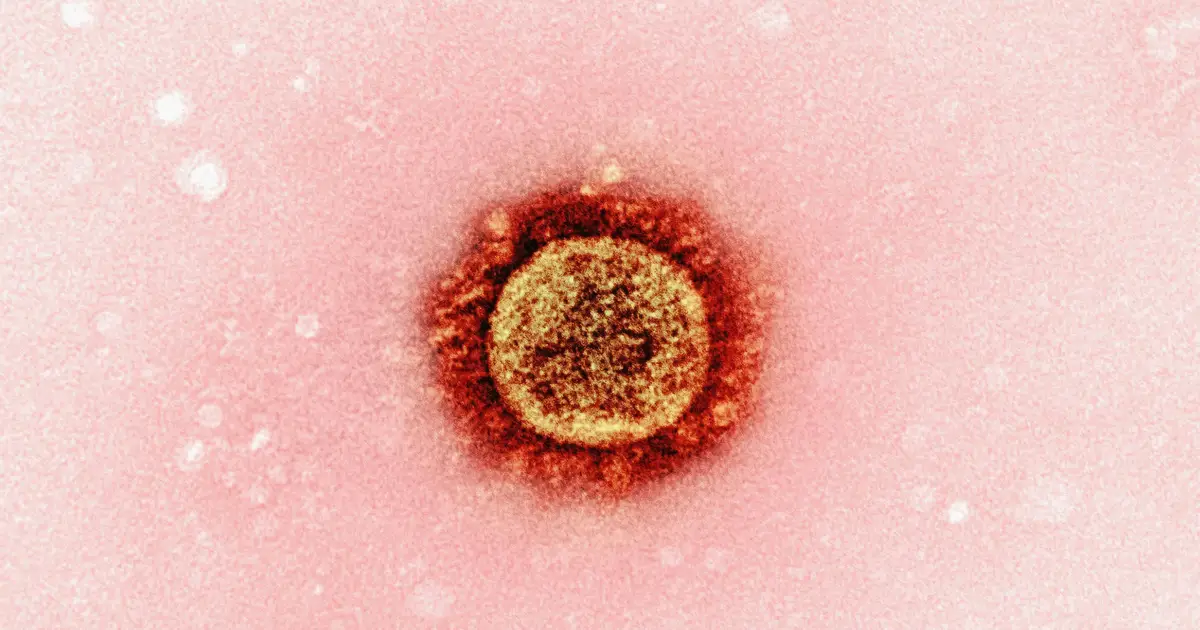 Contagious measles case reported at California theme park