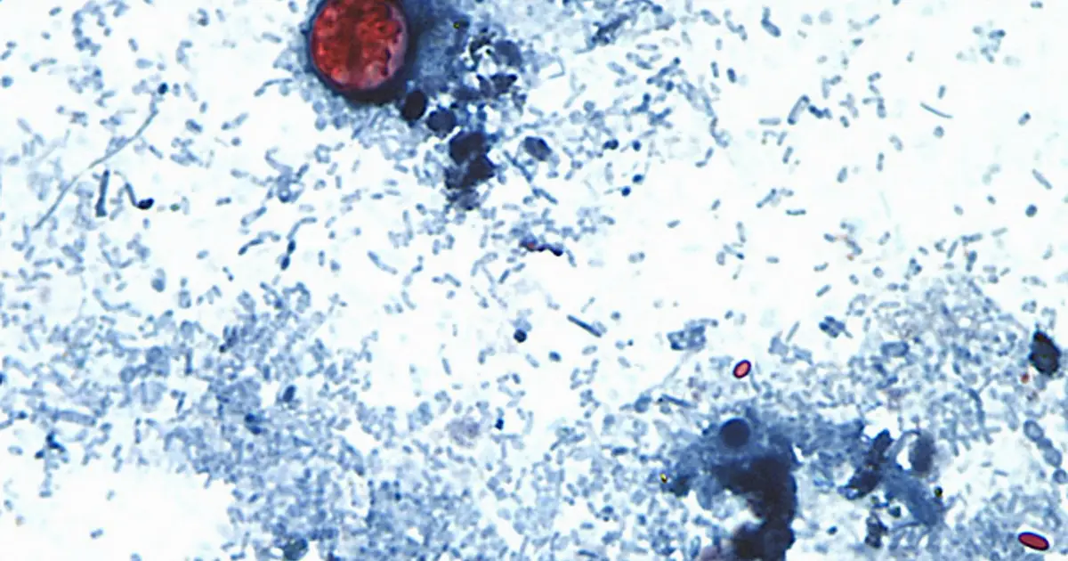 Michigan reports first 2 US deaths in outbreak of cyclospora