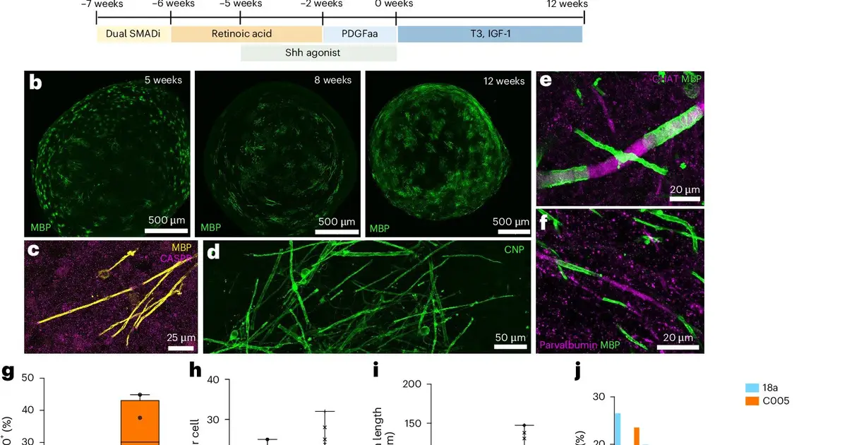 'Mini-brains' model myelin damage and regeneration, offering new tool for MS drug testing