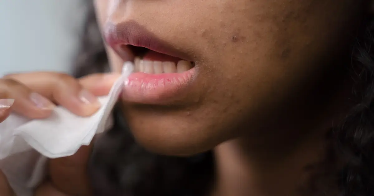 Why do I keep getting mouth ulcers?