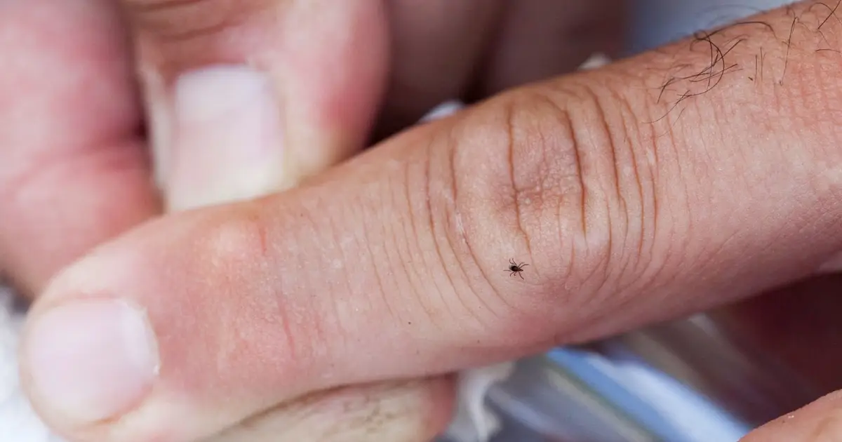 Newfound biomarkers may someday help clinicians better detect—and possibly cure—Lyme disease