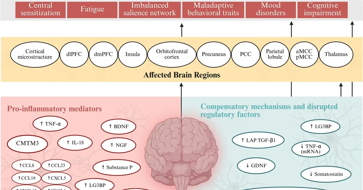 Neuroimmune abnormalities may play a key role in fibromyalgia