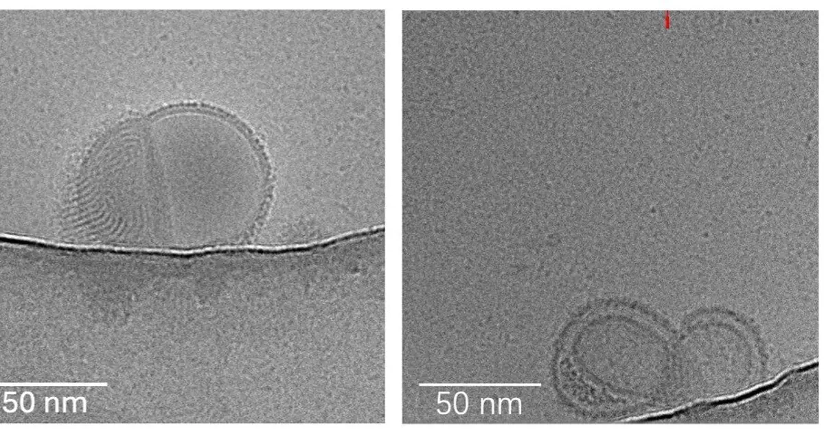 Nanomedicine discovery uses salt to overcome major obstacle in gene therapy