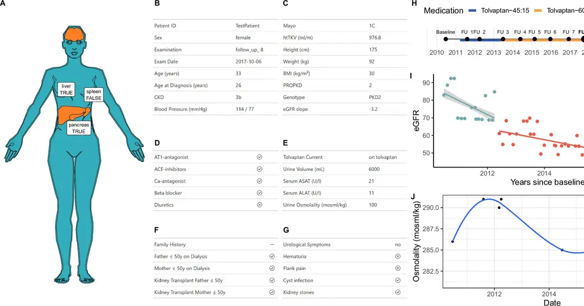New platform unites polycystic kidney disease data for near-real-time analysis