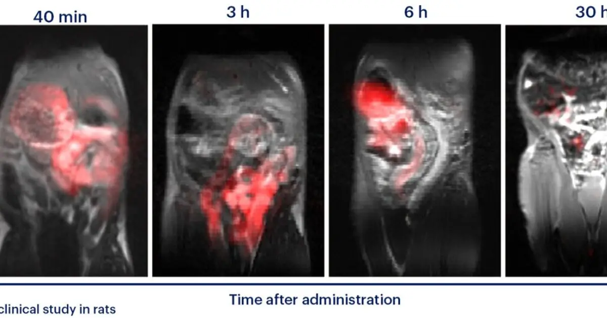 New polymer could enable gastrointestinal transit monitoring without ionizing radiation