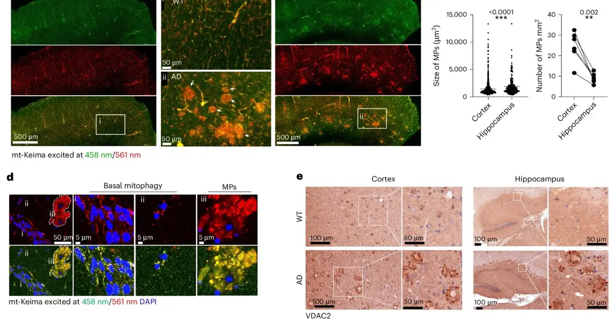 Newly identified mitochondrial plaques provide potential therapeutic target for Alzheimer's disease