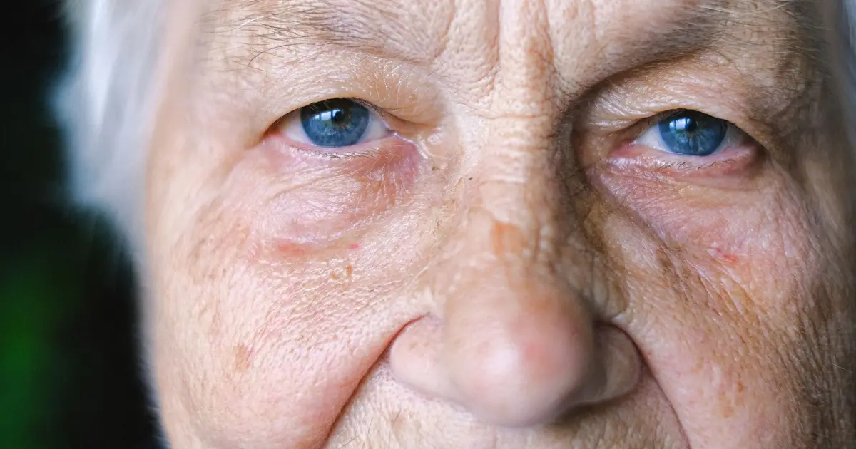 Early retinal dopamine imbalance appears across two inherited eye disease models
