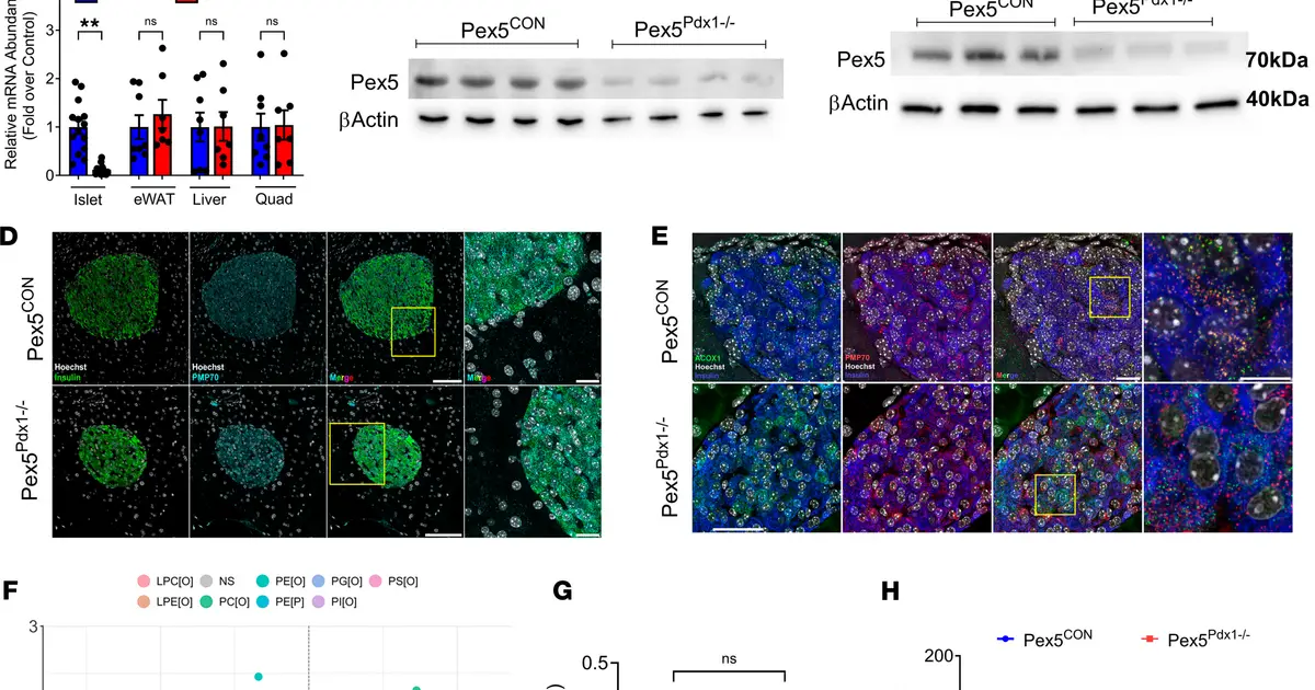 Peroxisome structure can help protect insulin and maintain beta cell health