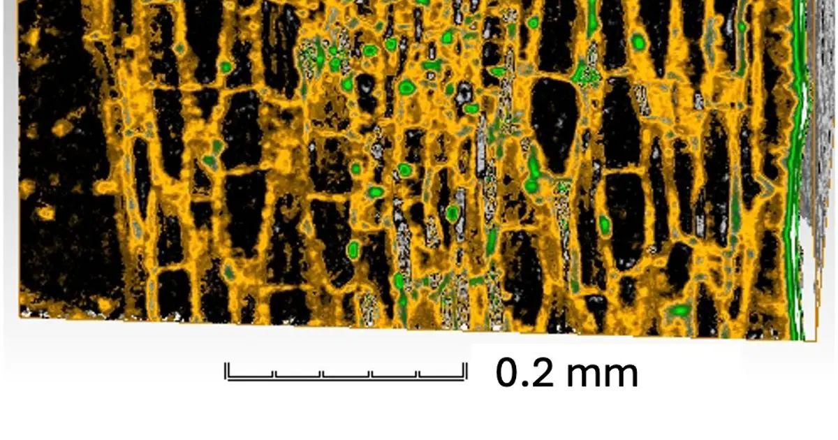 Phase-contrast microtomography reveals vascular colonization of tomato roots by Fusarium oxysporum