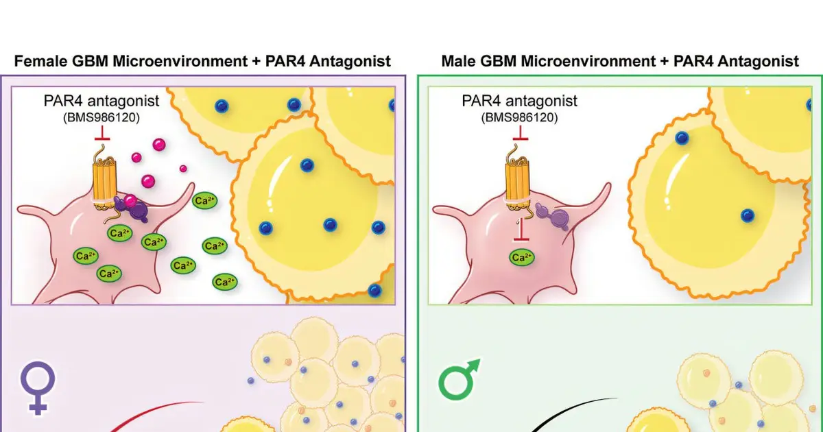 Platelets may play an unexpected role in glioblastoma progression