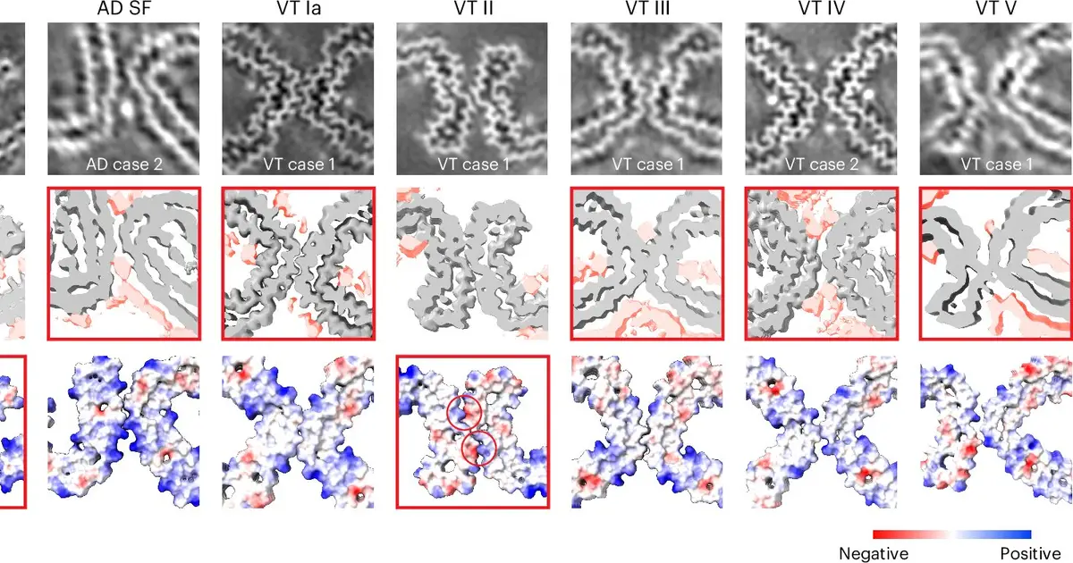 Polyubiquitin may stabilize tau filament structures in neurodegenerative diseases