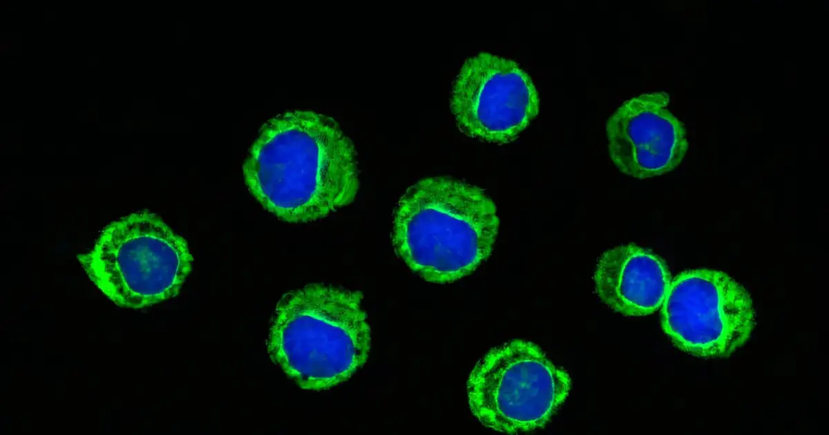 Pre-cancerous blood cells may fuel disease risk by prematurely aging the bone marrow