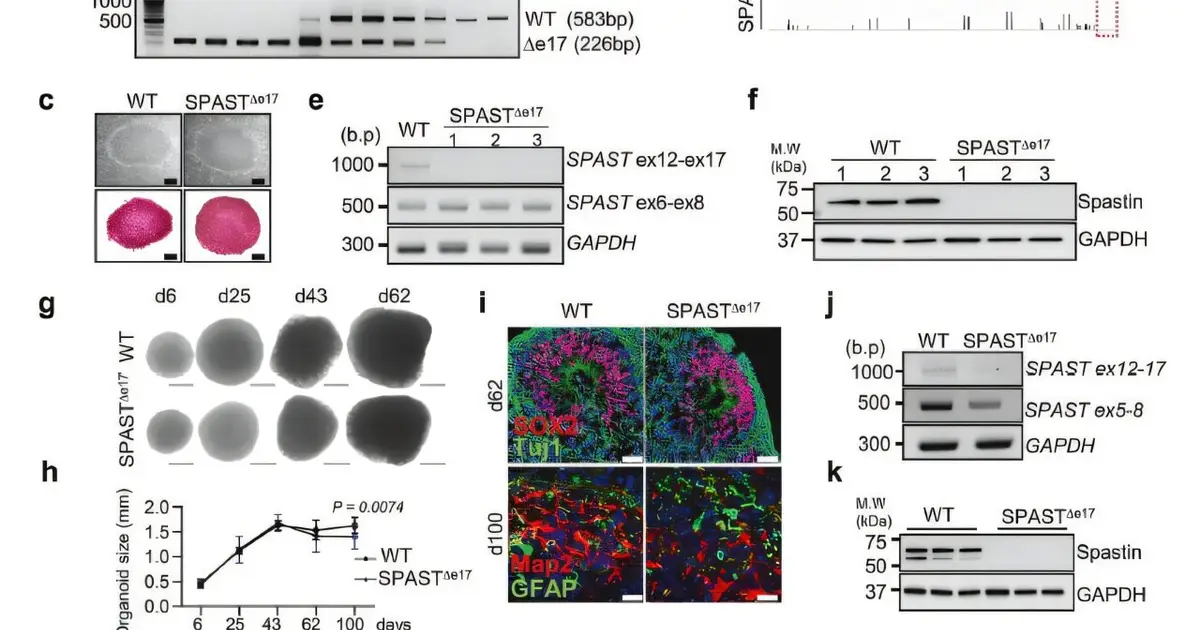 Primate-specific DNA change reveals a new link to dementia-related neurodegeneration