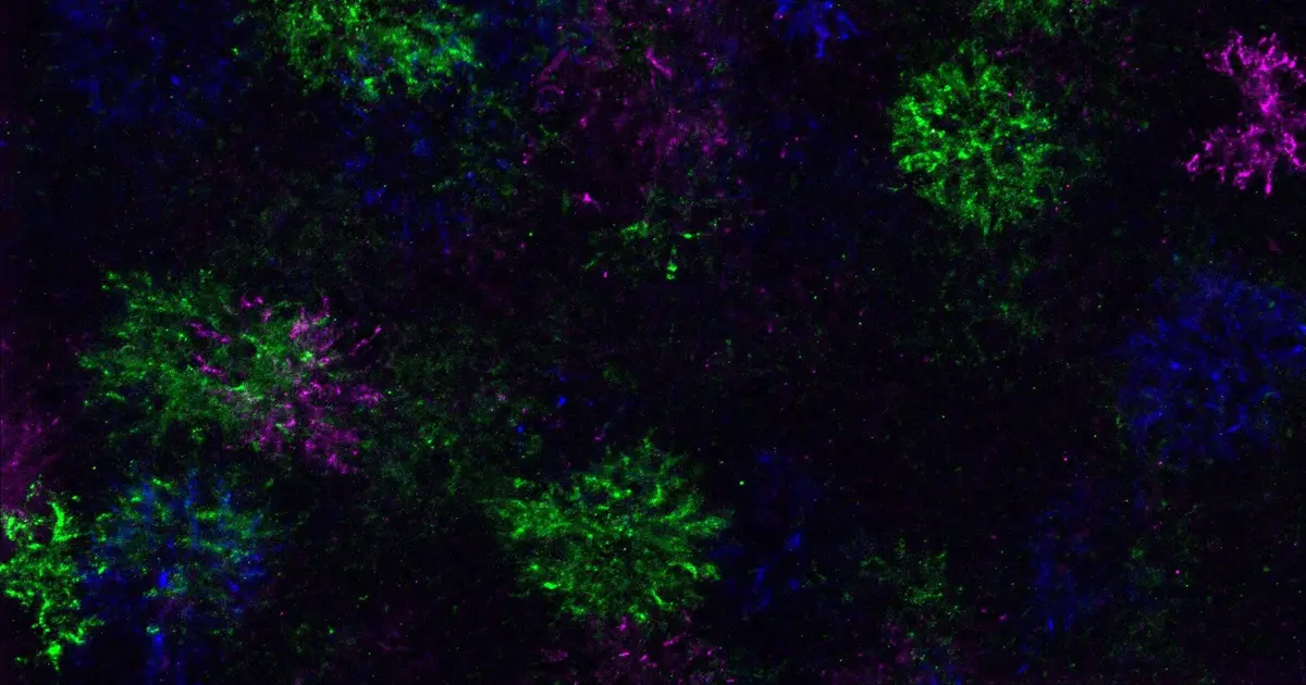 Progenitor cells constantly attempt to produce new myelin - producing brain cells , study finds