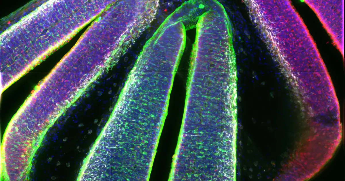 Multiomic atlas of the developing thalamus reveals how neuronal identities emerge