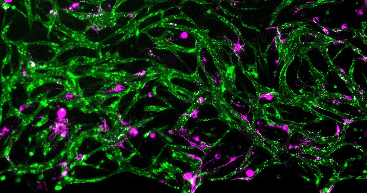 Miniaturized bone marrow-on-a-chip tracks human immune cells as they build lasting antibody defenses
