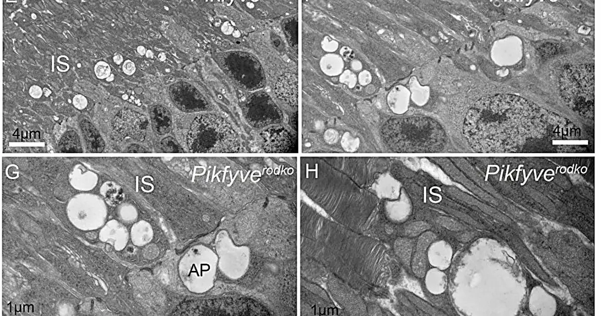 Hidden 'recycling system' helps keep vision cells healthy