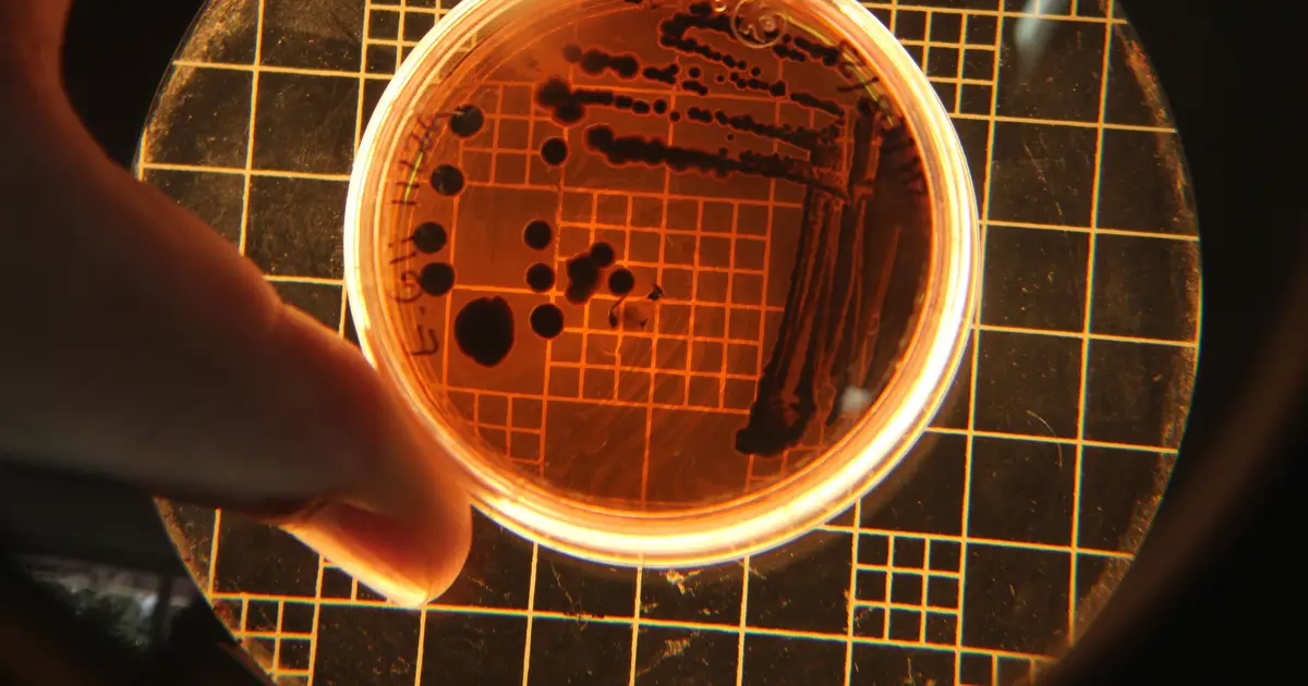Second-ever case of rare fungus resistant to four antifungal drug classes detected in Kenya