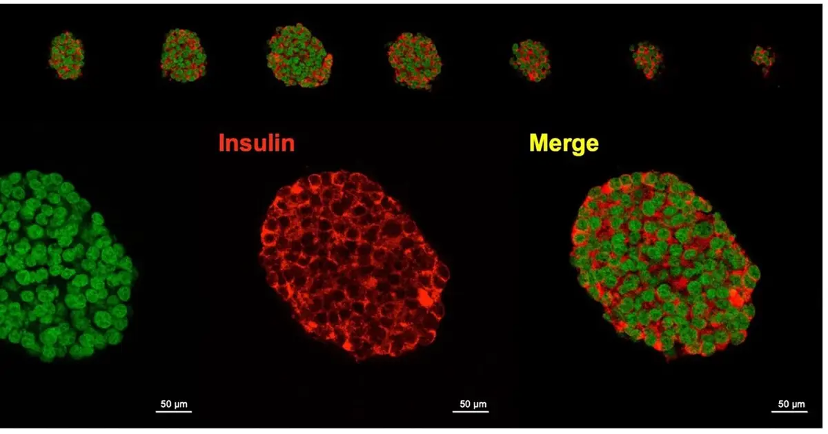 Single-gene edits fail to protect transplanted insulin-producing cells