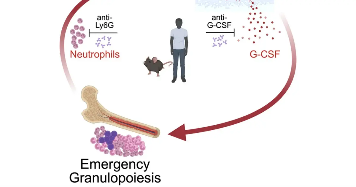 Skin-bone marrow axis discovery opens new doors for psoriasis treatment
