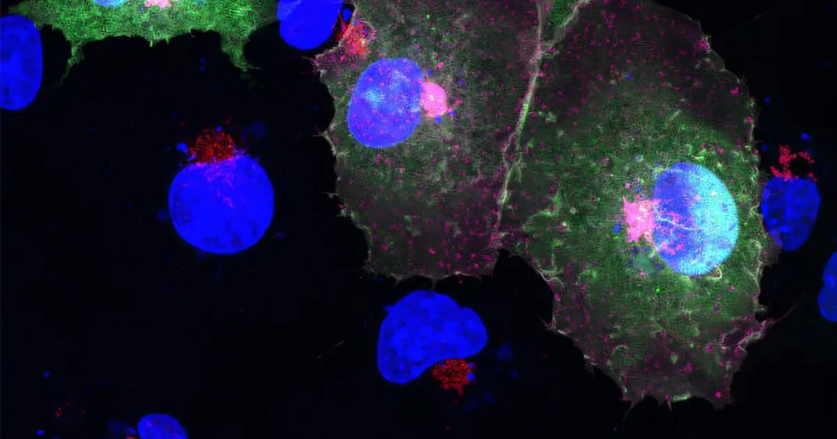 Solving a mysterious inflammatory fever opens the book on a much bigger story