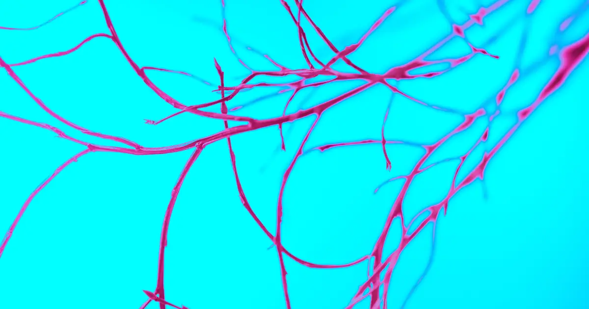 Somatic mutations linked to vascular damage in progeria